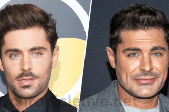 Why Zac Efron's Face Looks Different Explained