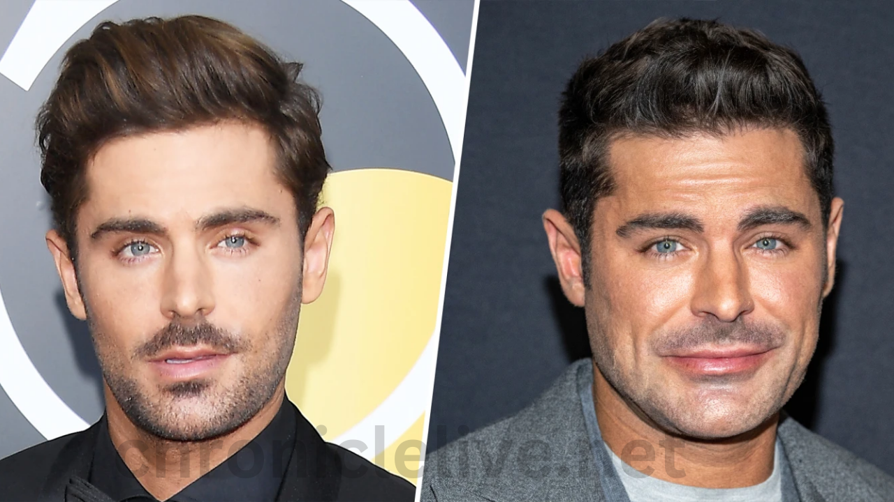 Why Zac Efron's Face Looks Different Explained